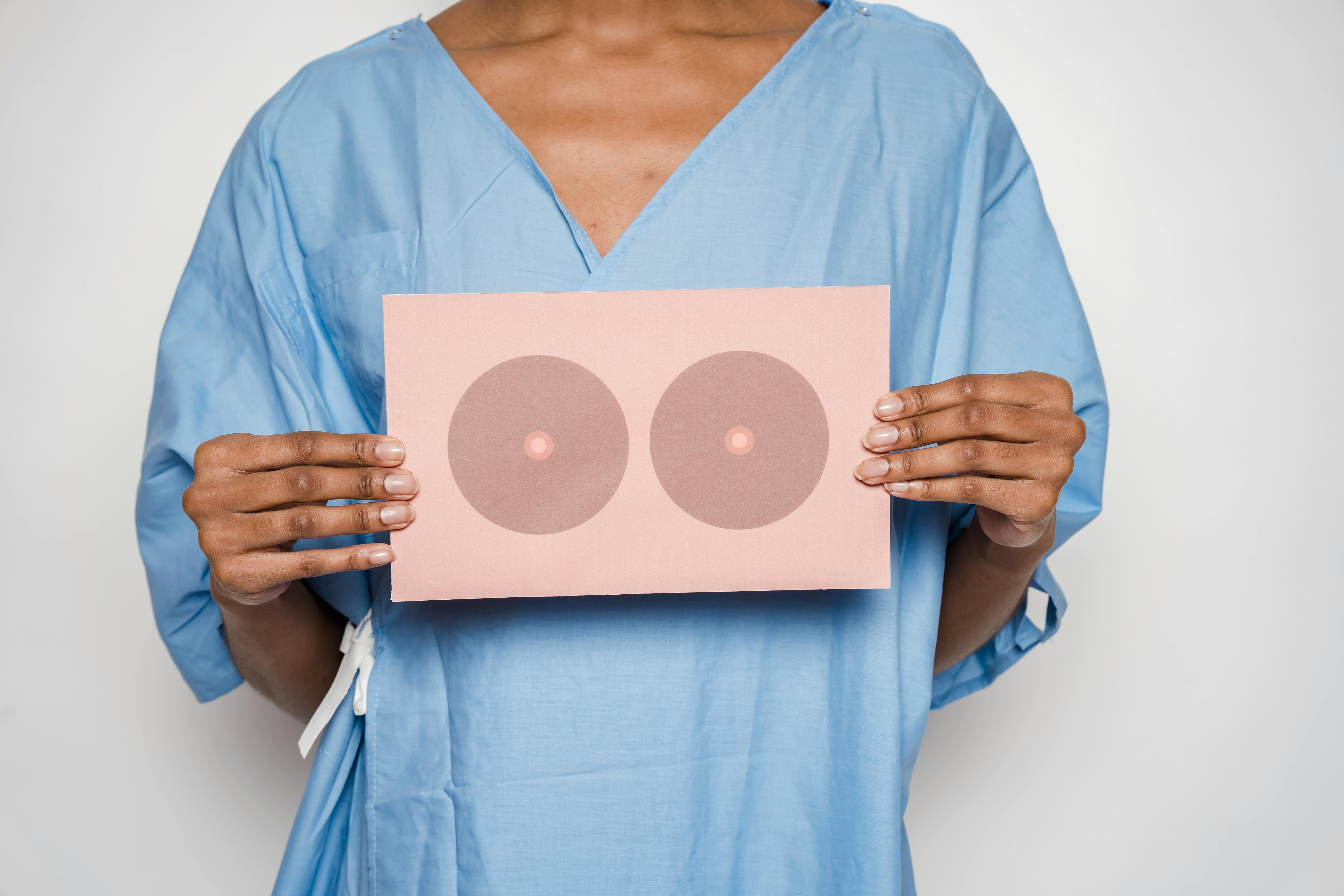 Breast Reduction in Albania: A Guide to Relief and Proportion