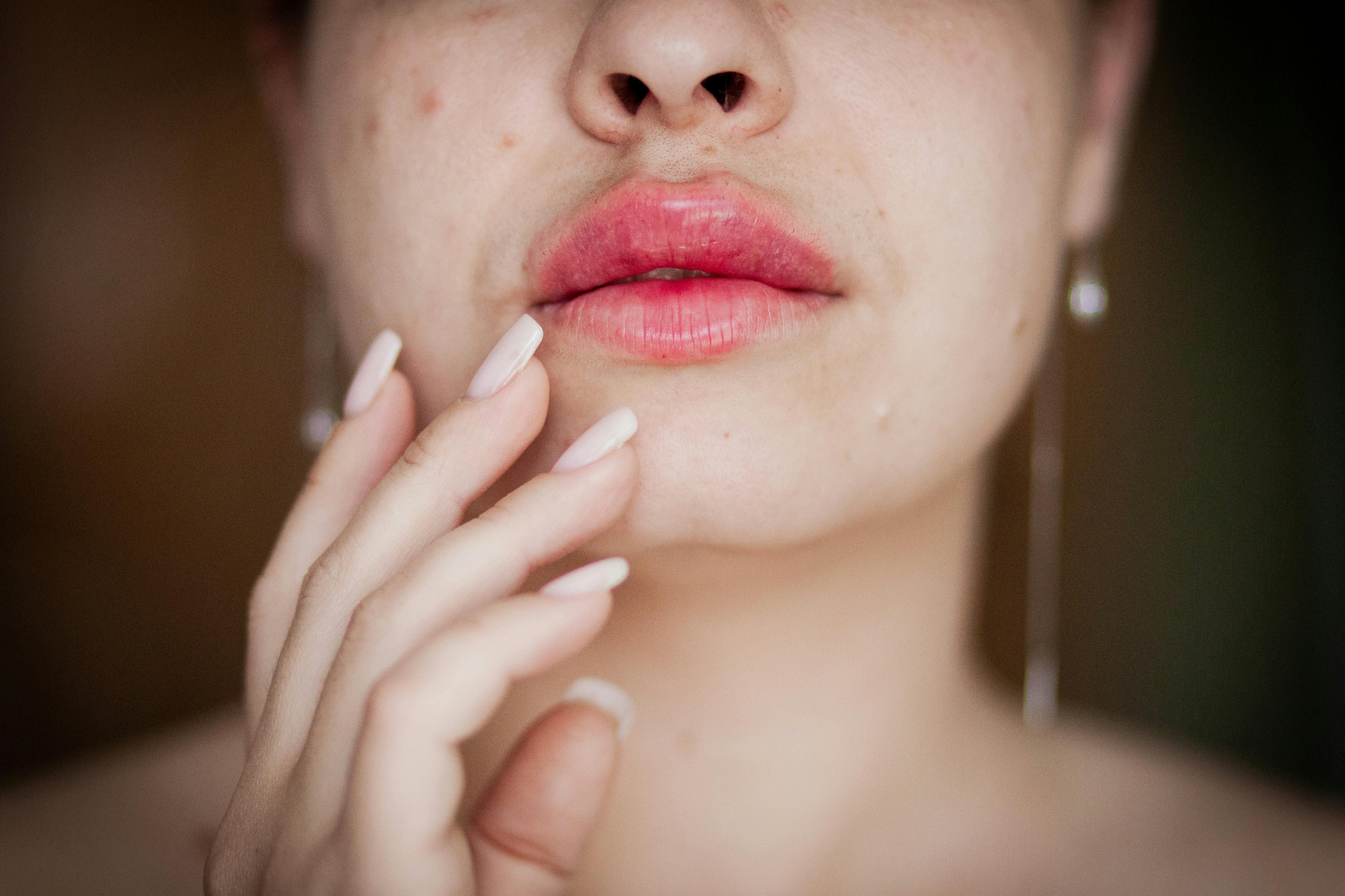 Lip Augmentation in Albania: A Guide to Fillers and Lip Lifts