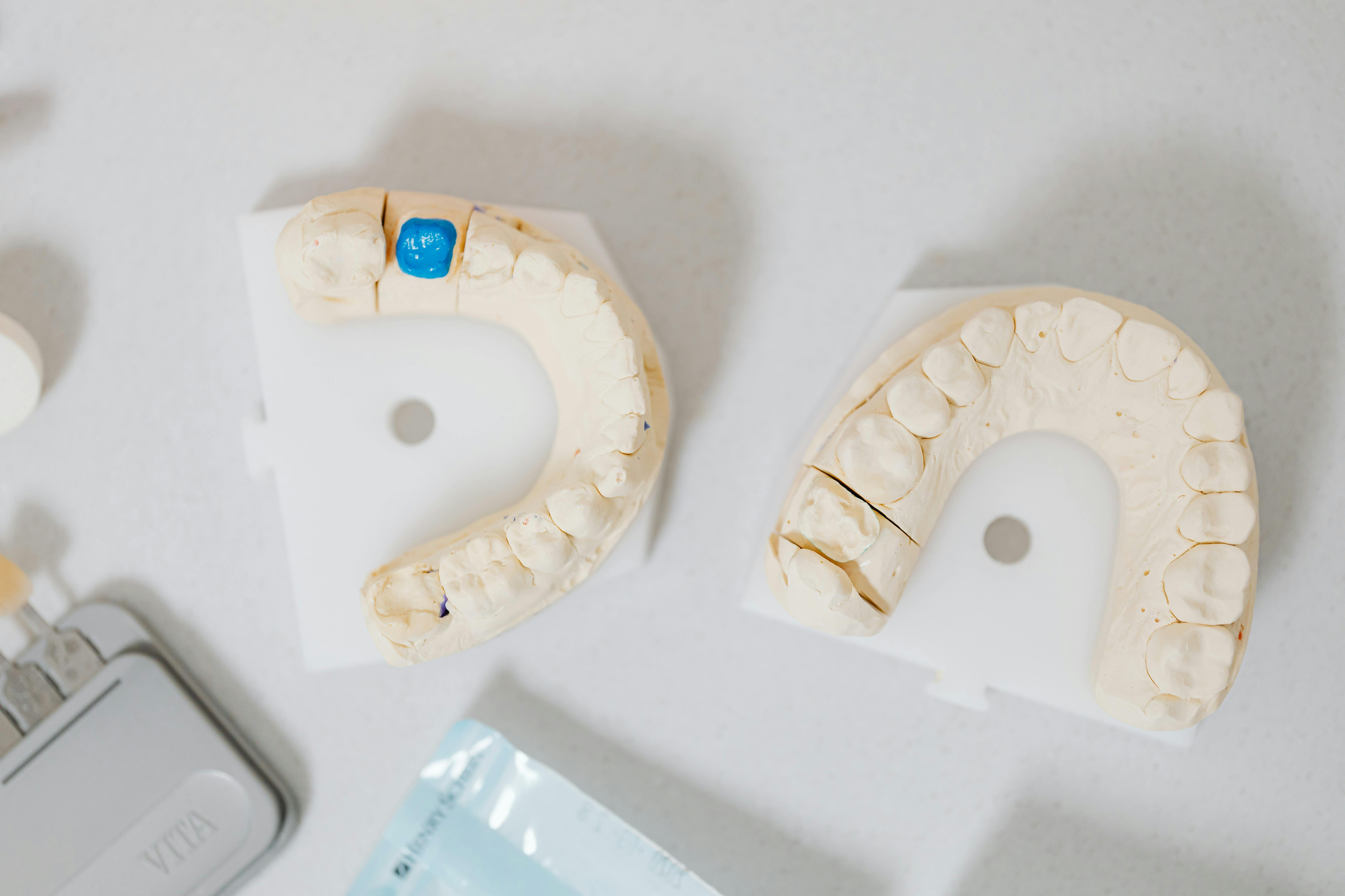Zirconium Crowns in Albania: A Guide to Strong, Natural-Looking Restorations